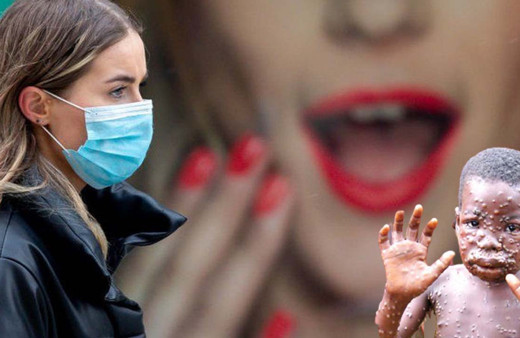 Yeni kabus maymun çiçeği virüsü şimdi de Almanya'da Dünya Sağlık Örgütü acil toplantı kararı aldı