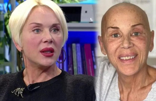 Acı haberle dünyası başına yıkıldı! Kansere yakalanan Billur Kalkavan duyurdu: Benden birçok pisliği aldı