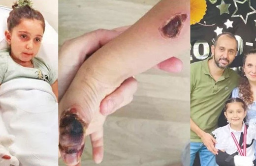 İstanbul'da MR çektikleri 7 yaşındaki Elif'i yaktılar!