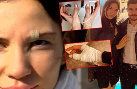 Futbolcu Özer Hurmacı ile eşi Mihriban Hurmacı'ya 1,5 yıla kadar hapis talebi