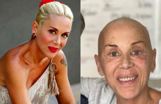 Akciğer kanseriyle savaşan Billur Kalkavan: "Kabulde ve akıştayım. Böylesi daha kolay."