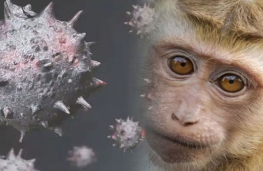 Prof Dr. Suzan Saçar maymun çiçeği hakkında konuştu: ''Ciddi hastalık riski!''