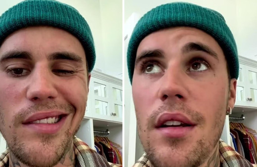 Yüz felci geçiren Justin Bieber'in son hali sevenlerini korkuttu dua istedi
