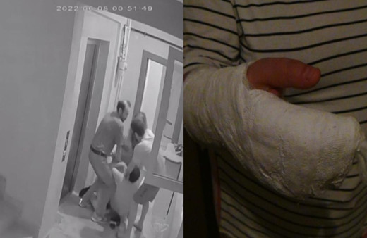Hamile eşinin parmakları kırıldı, kendisi yumruklandı! Komşu kavgası üzücü sonlandı