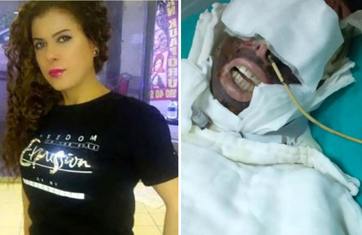 Kimyasalla yaktığı kadını yatağa mahkum eden sanık: Ben onu seviyorum