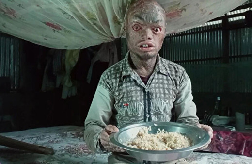 Hastalığına inanamayacaksınız! Her hafta deri değiştiriyor, çocuklar ondan kaçıyor