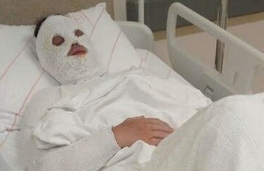 Eski nişanlısına kezzap atan şahıs "Su saatine bakacağım" bahanesiyle kapıyı açtırmış