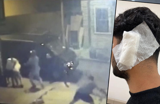 Alçılı kolla ve falçatayla saldırıp, kulağından ısırdı! Galata'da akılalmaz kavga