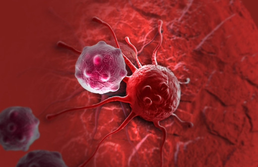 Bu belirtiler varsa dikkat! Kanserin habercisi olabilir...