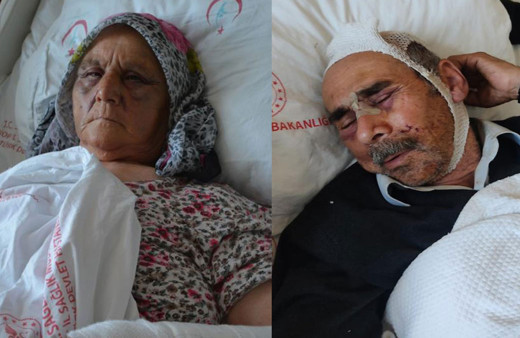 İki saat boyunca işkence uyguladı! Anne ve Babasını bu hale getirdi