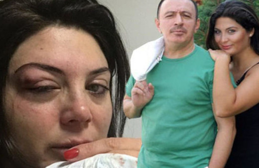 Mustafa Topaloğlu'nun eşinden kötü haber geldi! Duyanlar hastaneye koştu!