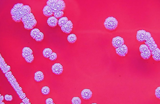 ABD'de ölümcül bakteri türü ortaya çıktı! Toprakta bulunuyor, ilk belirtisi ise...