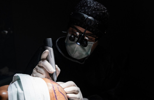 Uzman doktor Levent Acar’dan saç ekimi yaptıracaklara tavsiyeler