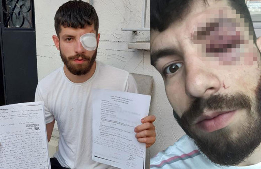 Sigortasız çalıştırılan işçi, sigorta isteyince olanlar oldu! Cam bardak fırlattıp, bu hale getirdiler...