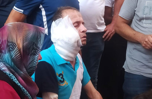 Zonguldak'ta komşu kadının boğazını baltayla kesip öldürdü eşini ağır yaraladı