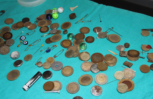 Midelerden çıkanlar şok etti! Ne ararsan var para, iğne, boncuk, pil, yüzük...