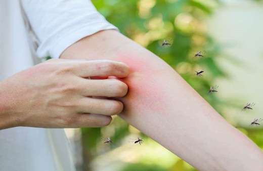 Kahrolası sivrisineklerle başınız dertte mi? Bu yöntemler sivrisinek ısırığına çok iyi geliyor