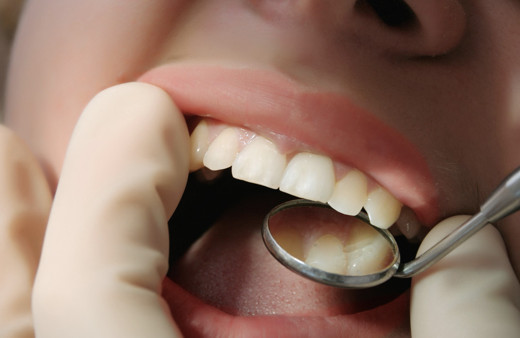 Dişim renk değiştirdi fırçalıyorum ama düzelmiyor diyorsanız bir de bunu deneyin!