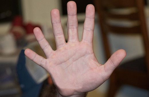 İşaret parmağınız yüzük parmağınızdan uzun mu! Kanser olabilirsiniz hemen bu testi yapın