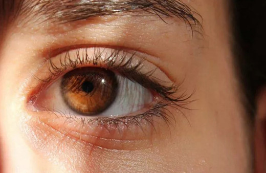 Sık sık gözleriniz seğiriyorsa dikkat Sebebi ciddi sorunlara yol açabilir