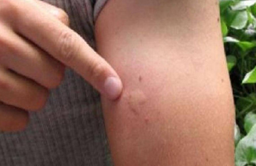 11 ölü 123 yaralı! Yunanistan'da alarm verildi 74 insanın sinir sistemini vurdu