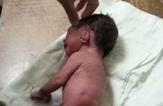 Boynuzla dünyaya geldi! Ayakları olmayan bebek şaşkına uğrattı