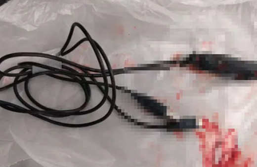 Cinsel organını ölçmek için yaptığı şey herkesi şaşkına uğrattı! Cinsel organına öyle bir şey soktu ki doktorlar bile çaresiz kaldı