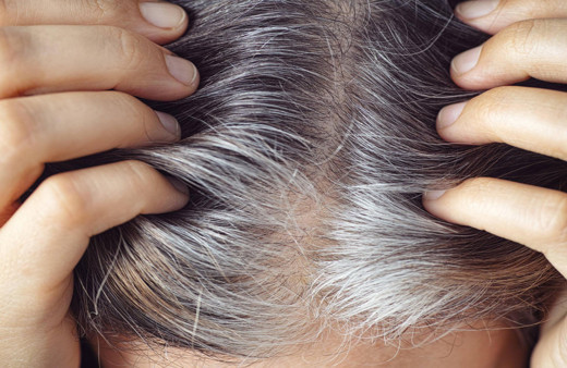 Saçları en çok beyazlatan besinler açıklandı! Sofralarınızdan uzak tutun