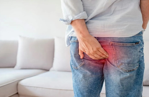 Hemoroid ile başınız dertteyse bu yöntemleri mutlaka deneyin! En etkili doğal ilaçlar