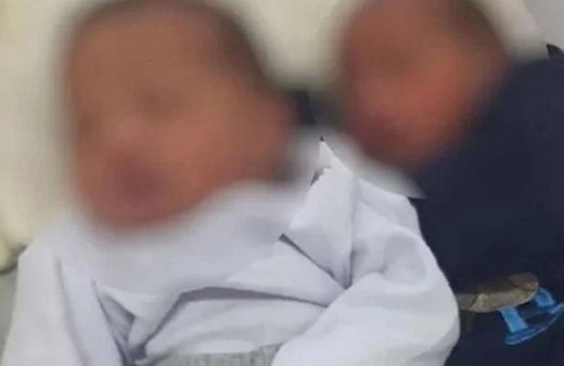 Aynı gün iki erkekle cinsel ilişkiye girdi, ikiz bebek doğurdu! İkizlerin annesi aynı babaları farklı