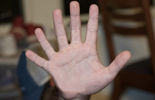 Parmaklarınıza bakın ve hemen bu testi yapın! Kanser olabilirsiniz