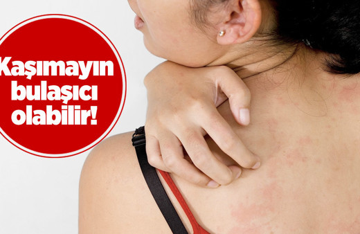 Görmezden gelmeyin hemen doktora koşun! Vücuttaki kırmızı lekeler alarm sebebi