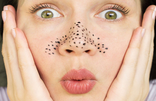 Baş belası siyah noktalar artık canınızı sıkmasın! İşte siyah noktalardan kolayca kurtulmanın püf noktaları