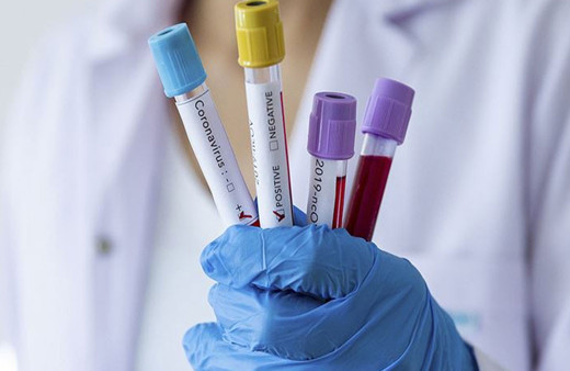 MCH nedir? MCH düşüklüğü ve yüksekliği nedir?  Kan değerlerinde MCH düşükse ne olur?