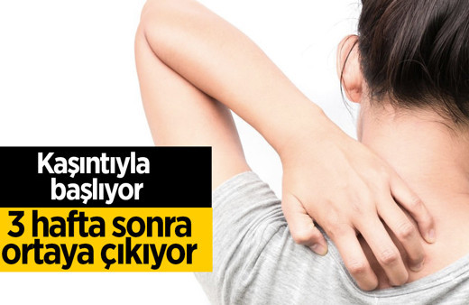 3 hafta sonra ortaya çıkıyor kaşıntıyla başlıyor! Aman dikkat kuduz olabilirsiniz
