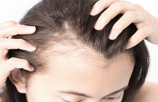 Sürün saçınız fışkırsın İşte saç dökülmesine meydan okuyan kür tarifi