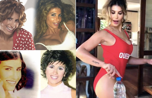 Şarkıcı Hatice dişinden tırnağına başka biri oldu! Estetikli halini gören doktorunu tebrik ediyor "değişime bakın"