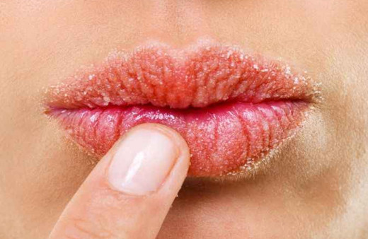 Etkisi dudak dolgusunu aratmıyor dudak dolgunlaştırmak için doğal kürler!