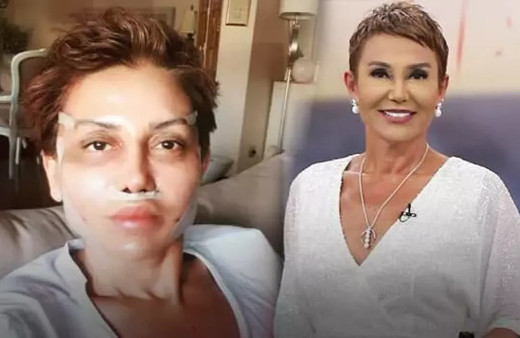 Serap Paköz estetik yaptırdı tanınmaz hale geldi! Takipçileri ''Yüzüne ne yaptın'' dedi