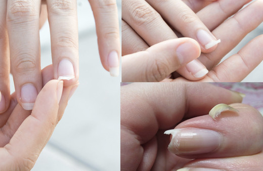 Tırnak bozulmasının nedenleri sakın hafife almayın! Ciddi hasta olabilirsiniz