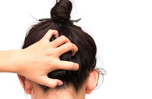 Kepek probleminiz varsa bu alışkanlıkları derhal bırakın