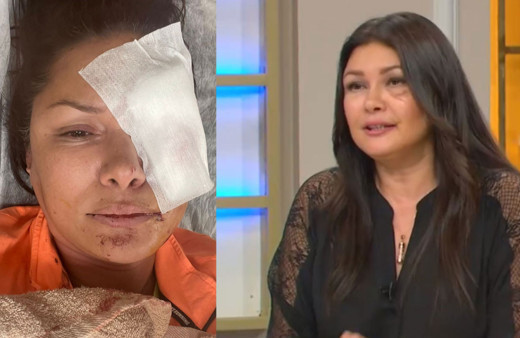 Köpek yüzünü parçalamıştı! Tuğba Altıntop korku dolu anları anlattı: "Ayağa kalktığın an ortalık kan revan"