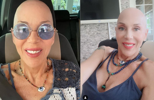 Billur Kalkavan evli mi çocuğu var mı? Billur Kalkavan evlilikleri, eşleri ve sevgilisi kimdir?