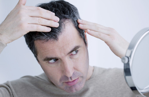 Kel olmak istemiyorsanız bunlardan uzak durun! Tüm saçınız dökülebilir...