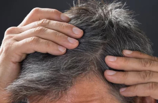 Saçlardaki beyazları boya kullanmadan azaltacak formül!