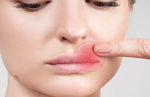 Dudağınızda çıkan uçuğu yok edecek doğal karışım! Günde 4 kez sürün sonucu görün