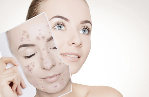 Kasım ayı başlayınca cildim pul pul dökülüyor diyenler bu haber size