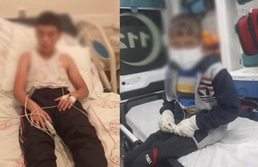 Türkiye diken üstünde! Kuduz vakasında çok kritik detay 24 saat içinde...