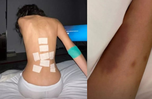 Dünyaca ünlü model Bella Hadid hastanelik oldu sebebini duyanlar şaştı kaldı!