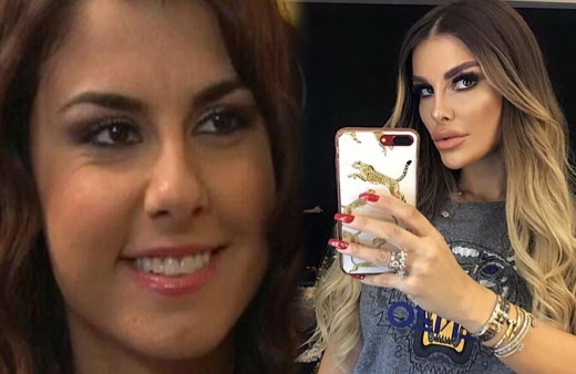 Adanalı'nın yıldızı estetikle bambaşka birine dönüştü eleştirilere yanıt verdi